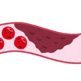 血管年齢って何？　高血圧から血管年齢をチェックした・・結果は
